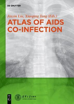 Atlas of AIDS Co-infection(English, Electronic book text, unknown)