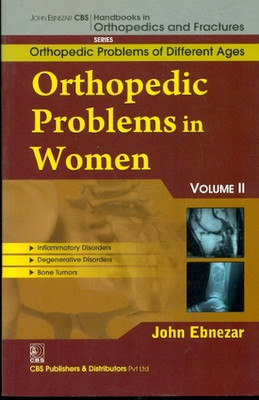 John Ebnezar CBS Handbooks in Orthopedics and Factures: Vol. 2(English, Paperback, Ebnezar John)