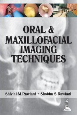 Oral and Maxillofacial Imaging Techniques 1/E Edition(English, Paperback, Rawlani Shivlal M.)