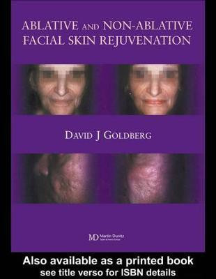 Ablative and Non-ablative Facial Skin Rejuvenation(English, Electronic book text, Goldberg David J.)