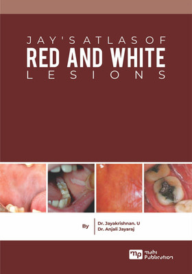 JAY’S ATLAS OF RED AND WHITE LESIONS(English, Paperback, Dr. Jayakrishnan. U)