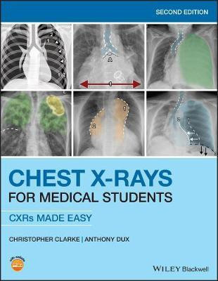 Chest X-Rays for Medical Students(English, Electronic book text, Clarke Christopher)