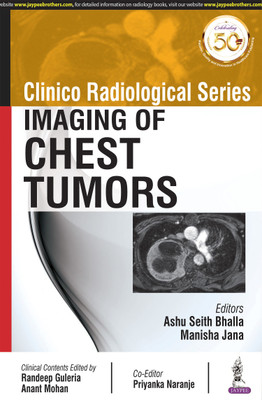 Clinico Radiological Series: Imaging of Chest Tumors(English, Paperback, Bhalla Ashu Seith)