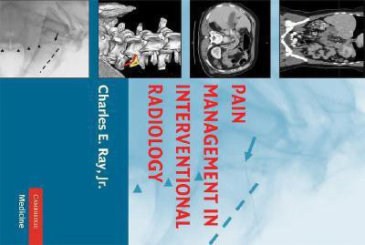 Pain Management in Interventional Radiology(English, Hardcover, unknown)
