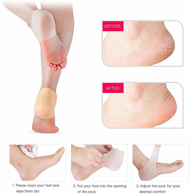 infinity deal (VE_DW540) Heel Socks Silicone Heel anti-Crack Sets Heel Support (White) Heel Support(Brown)