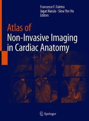 Atlas of Non-Invasive Imaging in Cardiac Anatomy(English, Hardcover, unknown)
