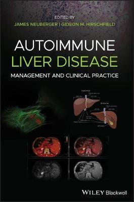 Autoimmune Liver Disease(English, Electronic book text, unknown)