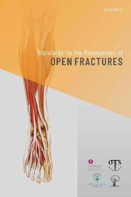 Standards for the Management of Open Fractures(English, Paperback, unknown)