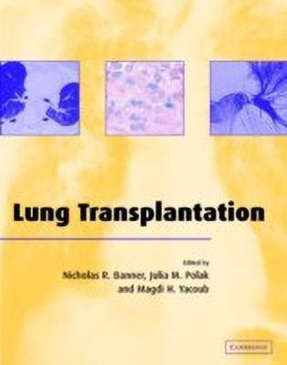 Lung Transplantation(English, Hardcover, unknown)