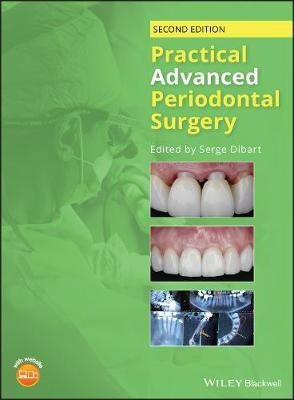 Practical Advanced Periodontal Surgery(English, Electronic book text, unknown)