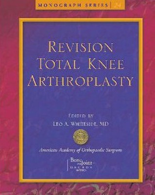 Revision Total Knee Arthroplasty(English, Paperback, Whiteside Leo A.)