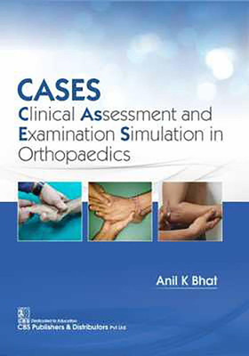 CASES: Clinical Assessment and Examination Simulation in Orthopaedics(English, Paperback, Bhat Anil)