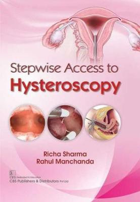 Stepwise Access to Hysteroscopy(English, Paperback, Sharma Richa)