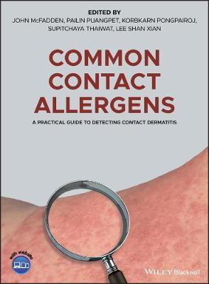 Common Contact Allergens(English, Electronic book text, unknown)