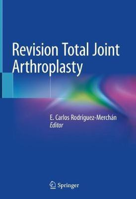 Revision Total Joint Arthroplasty(English, Hardcover, unknown)