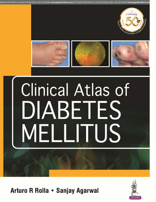 Clinical Atlas of Diabetes Mellitus 1 Edition(English, Paperback, Rolla Arturo R)