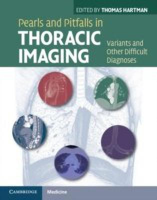 Pearls and Pitfalls in Thoracic Imaging(English, Hardcover, unknown)