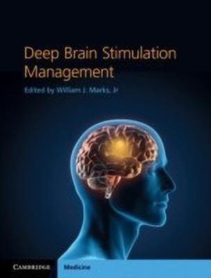 Deep Brain Stimulation Management(English, Hardcover, unknown)