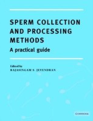 Sperm Collection and Processing Methods(English, Paperback, unknown)