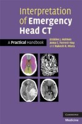 Interpretation of Emergency Head CT(English, Paperback, Holmes Erskine J.)