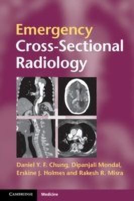 Emergency Cross-sectional Radiology(English, Paperback, Chung Daniel Y. F.)