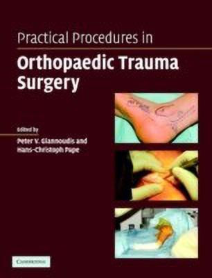 Practical Procedures in Orthopaedic Trauma Surgery(English, Paperback, Giannoudis Peter V.)