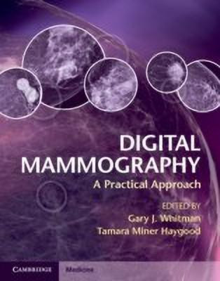 Digital Mammography(English, Hardcover, unknown)