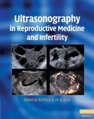 Ultrasonography in Reproductive Medicine and Infertility(English, Hardcover, unknown)