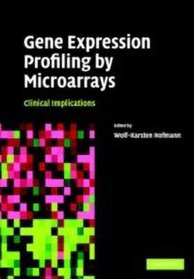 Gene Expression Profiling by Microarrays(English, Hardcover, unknown)
