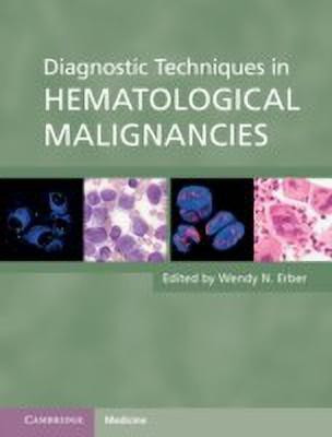 Diagnostic Techniques in Hematological Malignancies(English, Hardcover, unknown)
