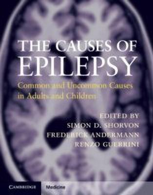 The Causes of Epilepsy(English, Hardcover, unknown)