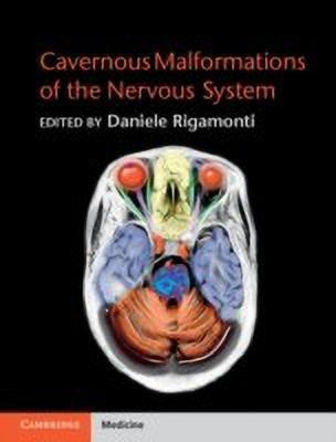Cavernous Malformations of the Nervous System(English, Hardcover, unknown)