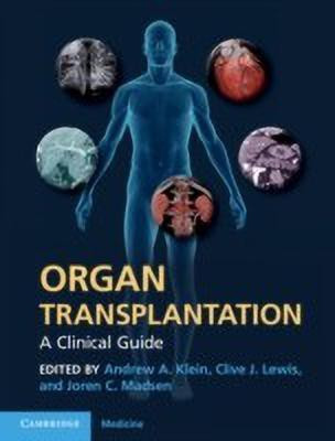Organ Transplantation(English, Hardcover, unknown)