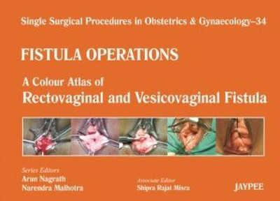 Single Surgical Procedures in Obstetrics and Gynaecology - 34 - Fistula Operations: A Colour Atlas of Rectovaginal and Vesicovaginal Fistula(English, Hardcover, Nagrath Arun)