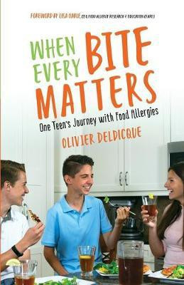 When Every Bite Matters(English, Paperback, Deldicque Olivier)