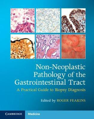 Non-Neoplastic Pathology of the Gastrointestinal Tract with Online Resource(English, Mixed media product, unknown)