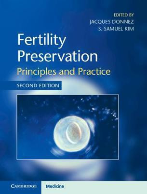 Fertility Preservation(English, Hardcover, unknown)