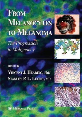 From Melanocytes to Melanoma(English, Paperback, unknown)