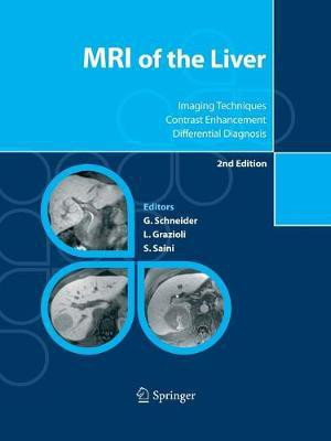 MRI of the Liver(English, Paperback, unknown)