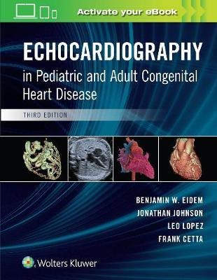 Echocardiography in Pediatric and Adult Congenital Heart Disease(English, Hardcover, unknown)