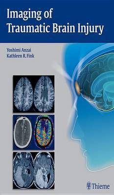 Imaging of Traumatic Brain Injury(English, Electronic book text, unknown)