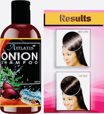 https://rukminim1.flixcart.com/image/400/400/kfpq5jk0/shampoo/r/a/t/200-onion-shampoo-with-caffeine-for-hair-growth-hairfall-control-original-imafw4bdekycrvcg.jpeg?q=90