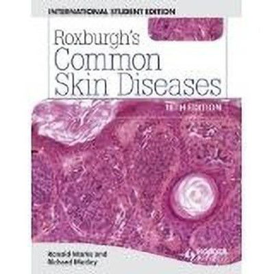 Common Skin Diseases 18th  Edition(English, Paperback, Marks Ronald)