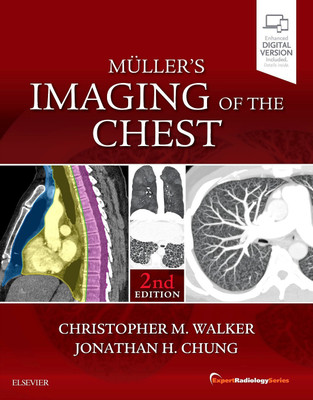 Muller's Imaging of the Chest(English, Hardcover, Walker Christopher M.)