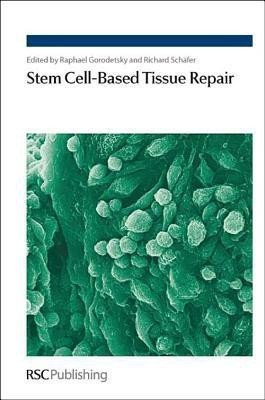 Stem Cell-Based Tissue Repair(English, Hardcover, unknown)