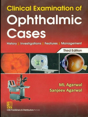 Clinical Examination of Ophthalmic Cases(English, Paperback, Agarwal M.L. MS FRCS)
