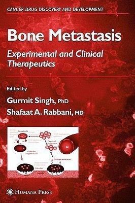 Bone Metastasis(English, Hardcover, unknown)