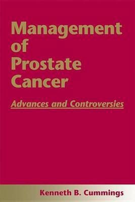 Management of Prostate Cancer(English, Electronic book text, unknown)