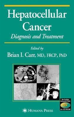 Hepatocellular Carcinoma(English, Mixed media product, Carr Brian)