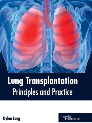 Lung Transplantation: Principles and Practice(English, Hardcover, unknown)